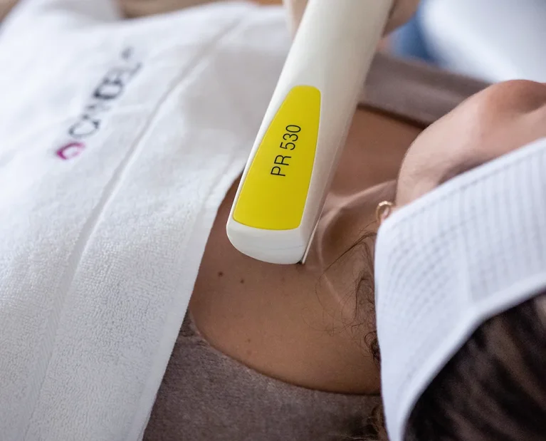 nordlys-swt-ipl-treatment-2_klhx3CR